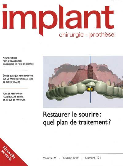 IMPLANT (Chirurgie - Prothèse)